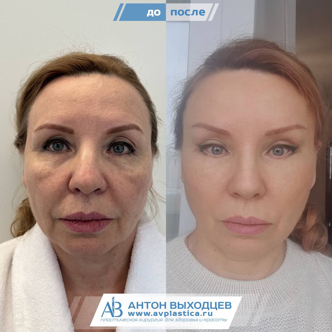 Пациентка 4